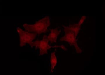 Polyclonal Rabbit anti-Human SRC Antibody (phospho-Ser75, IHC, IF, WB)