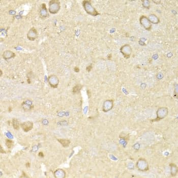 TRAP1 / HSP75 Antibody