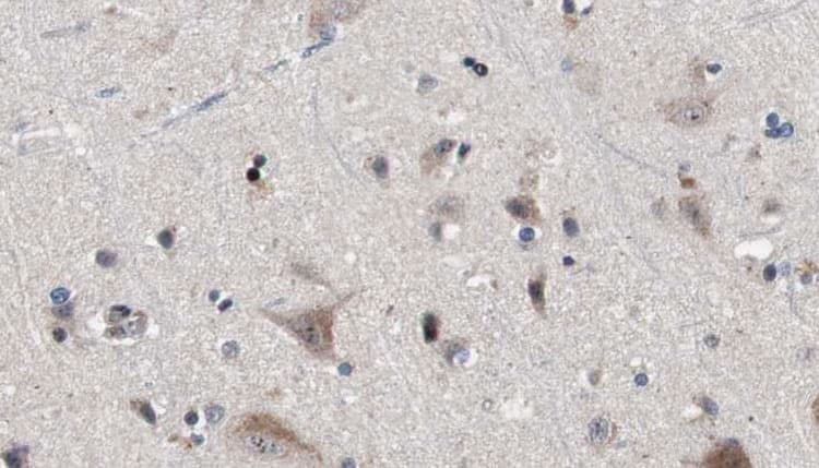IFT81 Antibody