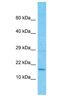 RPS18 / Ribosomal Protein S18 Antibody (aa101-150)