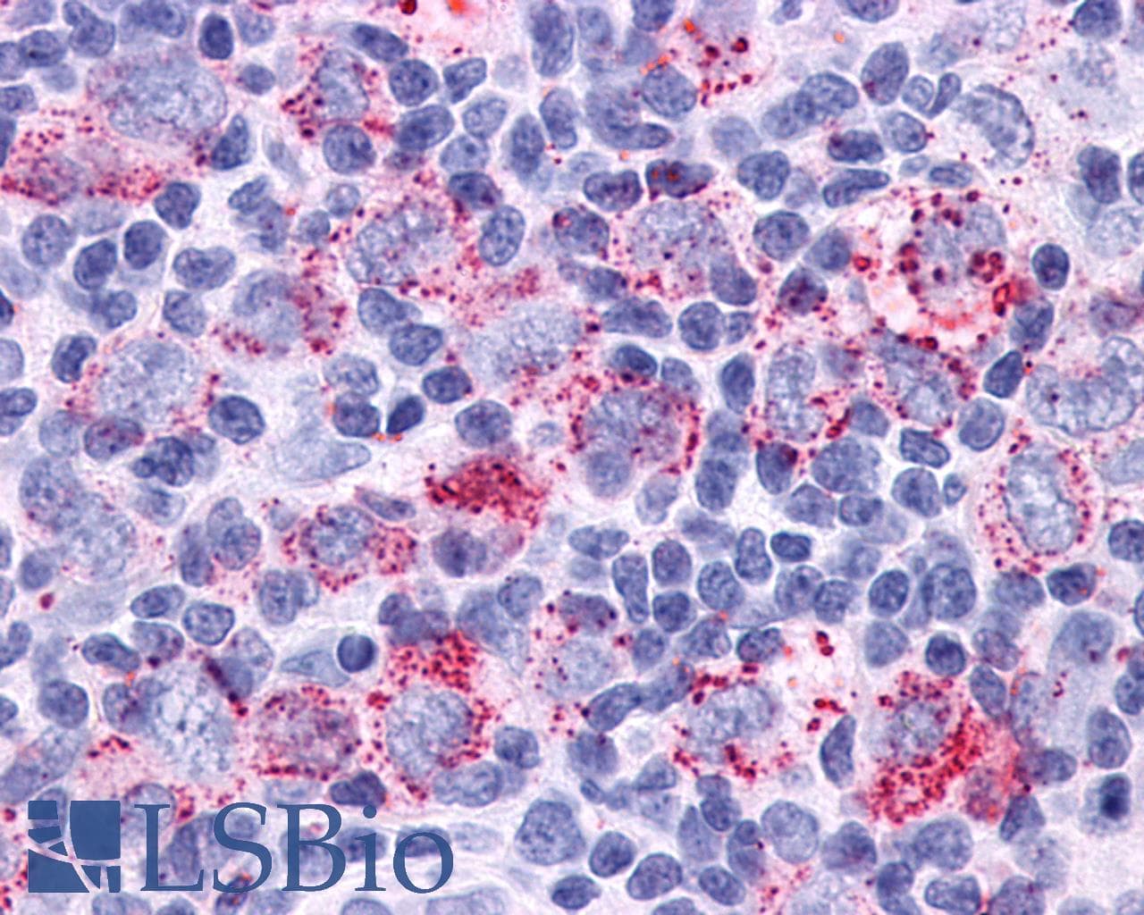 PathPlus™ GPR34 Antibody (C-Terminus)