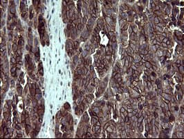 EPCAM Antibody (clone OTI3G2)