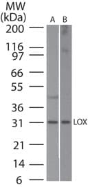 Polyclonal Rabbit anti-Human LOX / Lysyl Oxidase Antibody (aa305-320, IHC, WB)