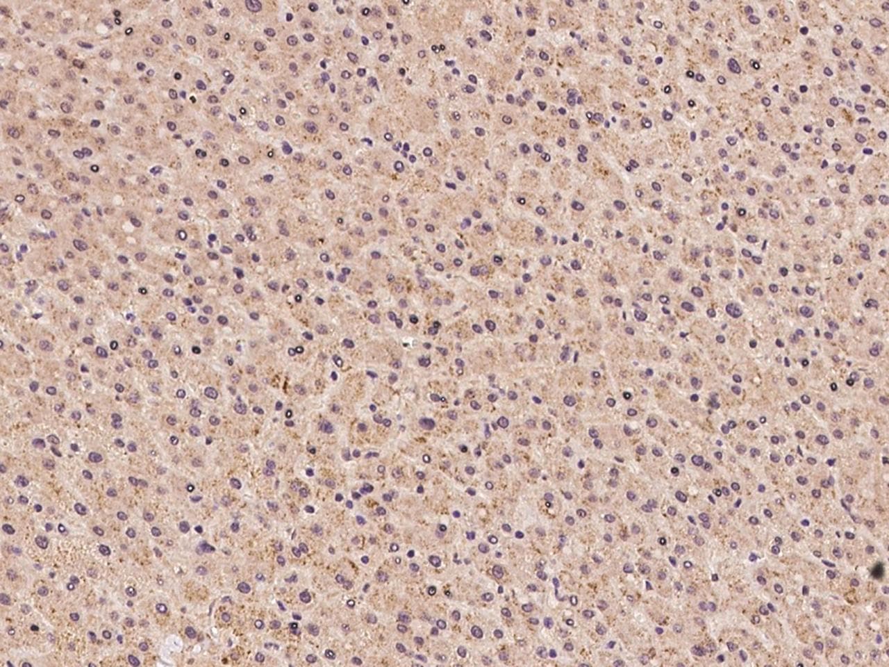 Polyclonal Rabbit anti-Human SLC25A41 Antibody (IHC)