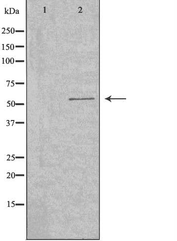 Polyclonal Rabbit anti-Human Spastic / GLRB Antibody (IF, WB)