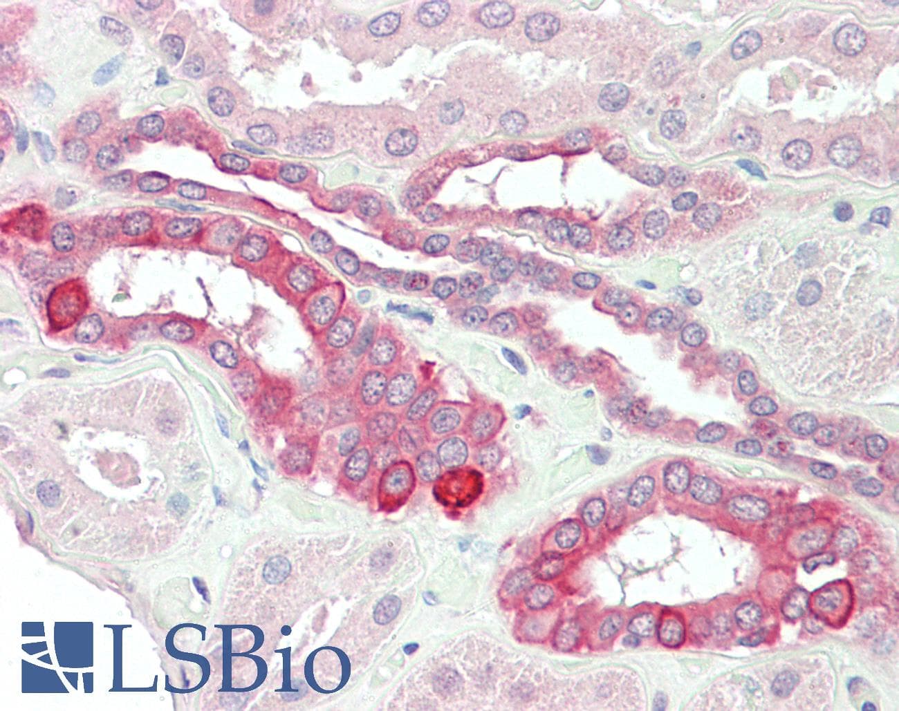PathPlus™ TNFRSF14 / CD270 / HVEM Antibody (200-280 aa, Internal)