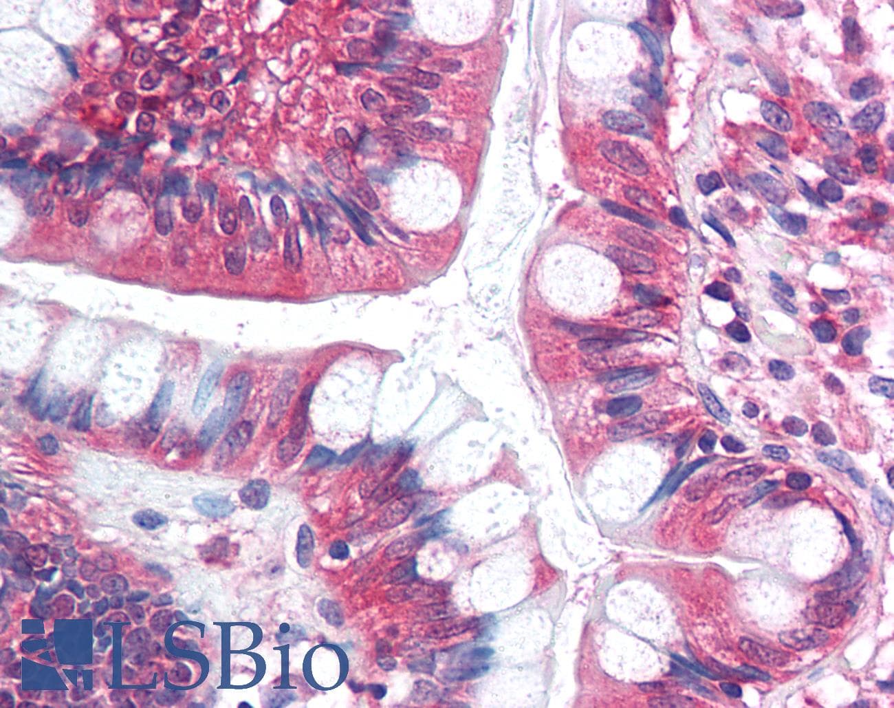 Polyclonal Rabbit anti-Human SF1 Antibody (aa517-566, IHC, WB)