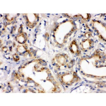 Polyclonal Rabbit anti-Human FZD1 / Frizzled 1 Antibody (aa369-400, IHC, WB)