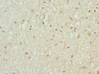 TARS Antibody
