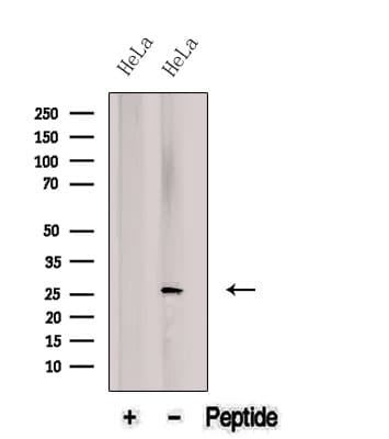 BNIP1 Antibody