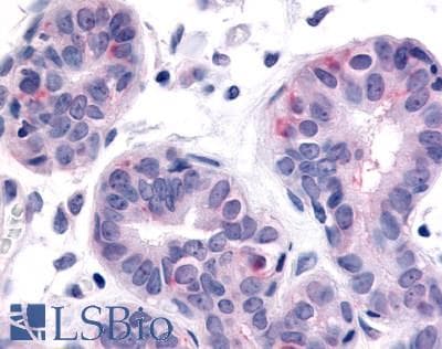 PathPlus™ Polyclonal Rabbit anti-Human HUNK / B19 Antibody (Internal, IHC)