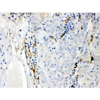 Polyclonal Rabbit anti-Human CYP1B1 Antibody (aa255-480, IHC, WB)