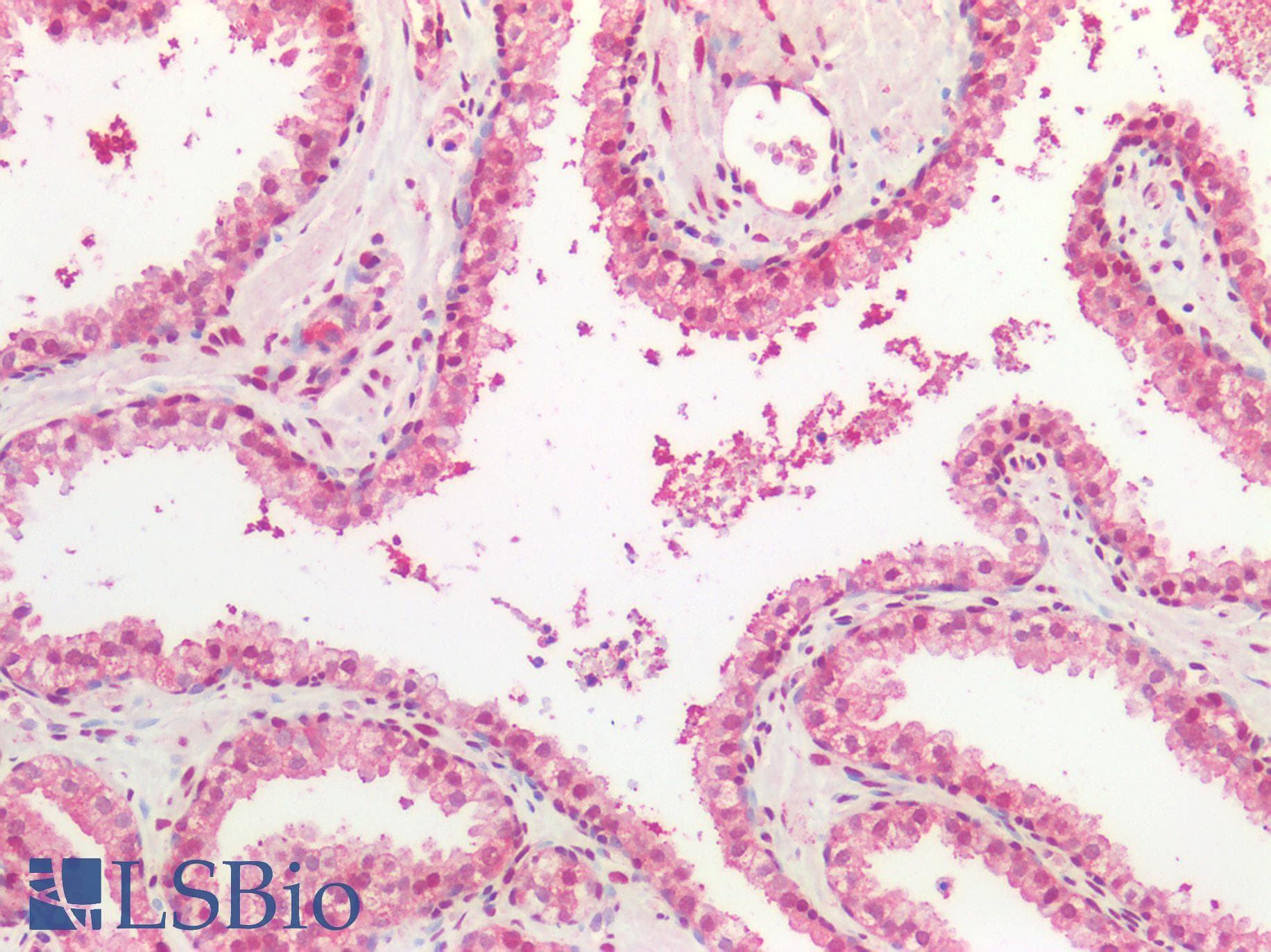 SPTBN4 Antibody (aa64-285)