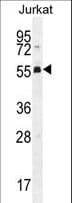 PODNL1 Antibody (aa167-195)