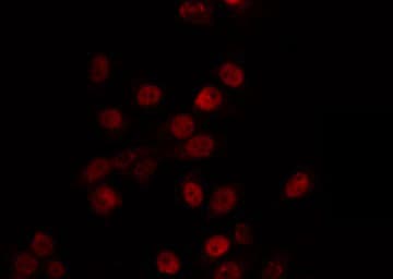 Polyclonal Rabbit anti-Human MBD3 Antibody (IF, WB)