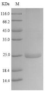 Horse LATH Protein (Recombinant 6His, N-terminus)