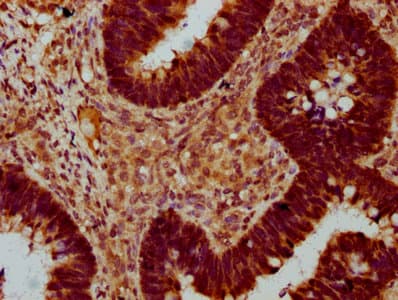 Polyclonal Rabbit anti-Human SOX30 Antibody (IHC, IF)