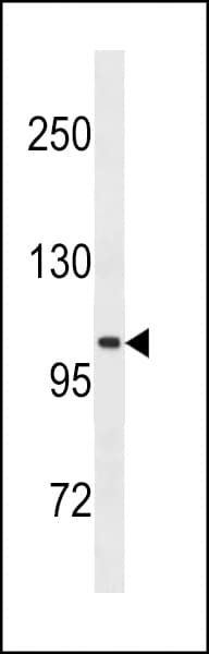 GPR49 / LGR5 Antibody (aa689-719)