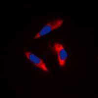 ITGB3 / Integrin Beta 3 / CD61 Antibody (C-Terminus)