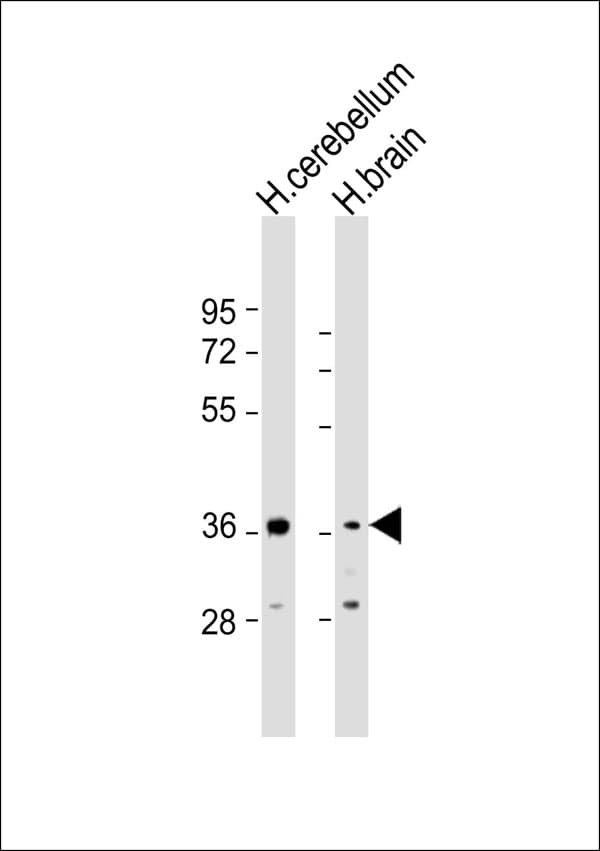 Polyclonal Rabbit anti-Human DOK6 Antibody (WB)