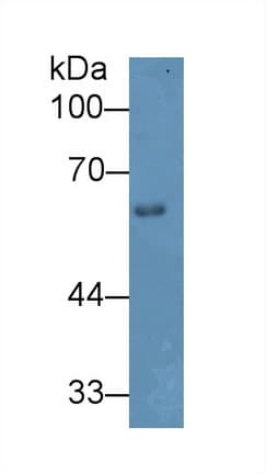HPSE / Heparanase Antibody (aa353-464, APC)