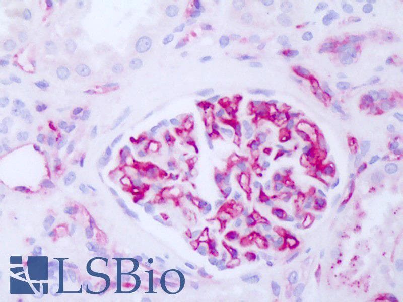 IHC-plus™ B2M / Beta 2 Microglobulin Antibody (clone B2M-01, Concentrated)
