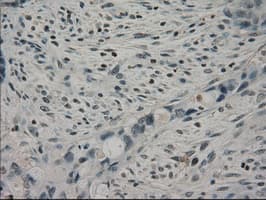 Monoclonal Mouse anti-Human CRYAB / Alpha B Crystallin Antibody (clone OTI4G5, IHC, WB)
