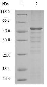 Mouse SETD4 Protein (Recombinant 6His, N-terminus)