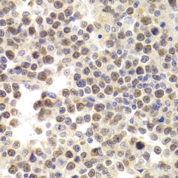 Polyclonal Rabbit anti-Human MCM4 Antibody (IHC, WB)