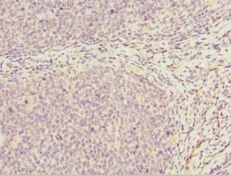 DDX20 / GEMIN3 Antibody