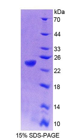 Human PTP4A1 / PRL-1 Protein (Recombinant His-T7, N-terminus)