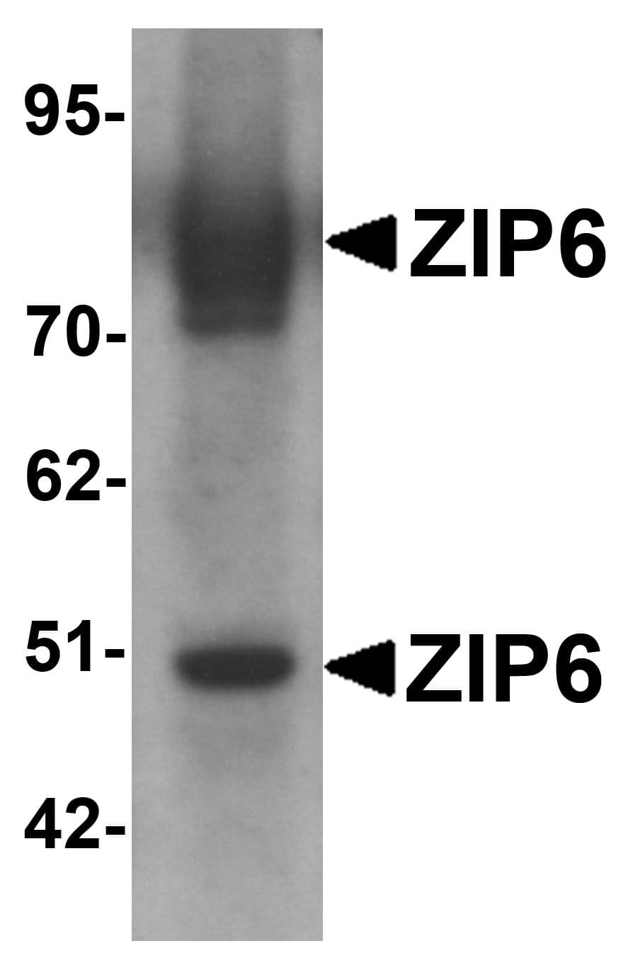 SLC39A6 / LIV-1 Antibody