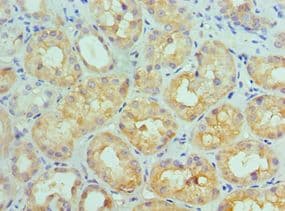 IL11RA Antibody (aa30-290)