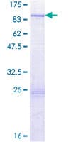 Human TTLL6 Protein (Recombinant GST)