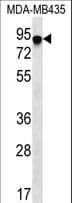ADAP / FYB Antibody (aa646-675)