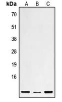 DEFB1 / BD-1 Antibody (Internal)