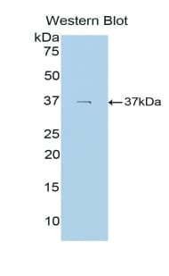 Osteocalcin Antibody (aa14-95)