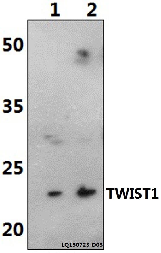 Polyclonal Rabbit anti-Human TWIST1 / TWIST Antibody (aa1-50, WB)