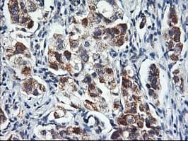 HARS2 Antibody (clone OTI5A9)