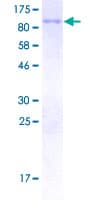 Human SCNN1B / ENaC Beta Protein (Recombinant GST)