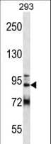 GCC1 / GCC88 Antibody (aa671-700)