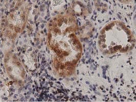 PRKD2 / PKD2 Antibody (clone OTI5G1)
