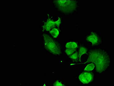 Polyclonal Rabbit anti-Human FANCC Antibody