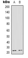 TMBIM4 / GAAP Antibody (Internal)