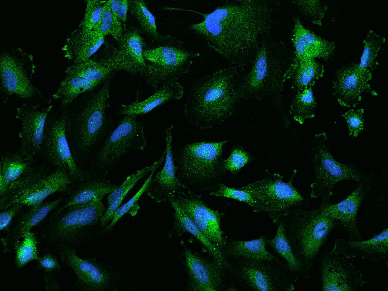 Polyclonal Rabbit anti-Human ANXA3 / Annexin A3 Antibody (IF)