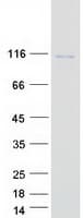 Human VPS41 Protein (Recombinant Myc-DDK (Flag))