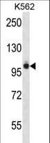 Polyclonal Rabbit anti-Mouse PTK2B / PYK2 Antibody (aa672-701, IHC, WB)