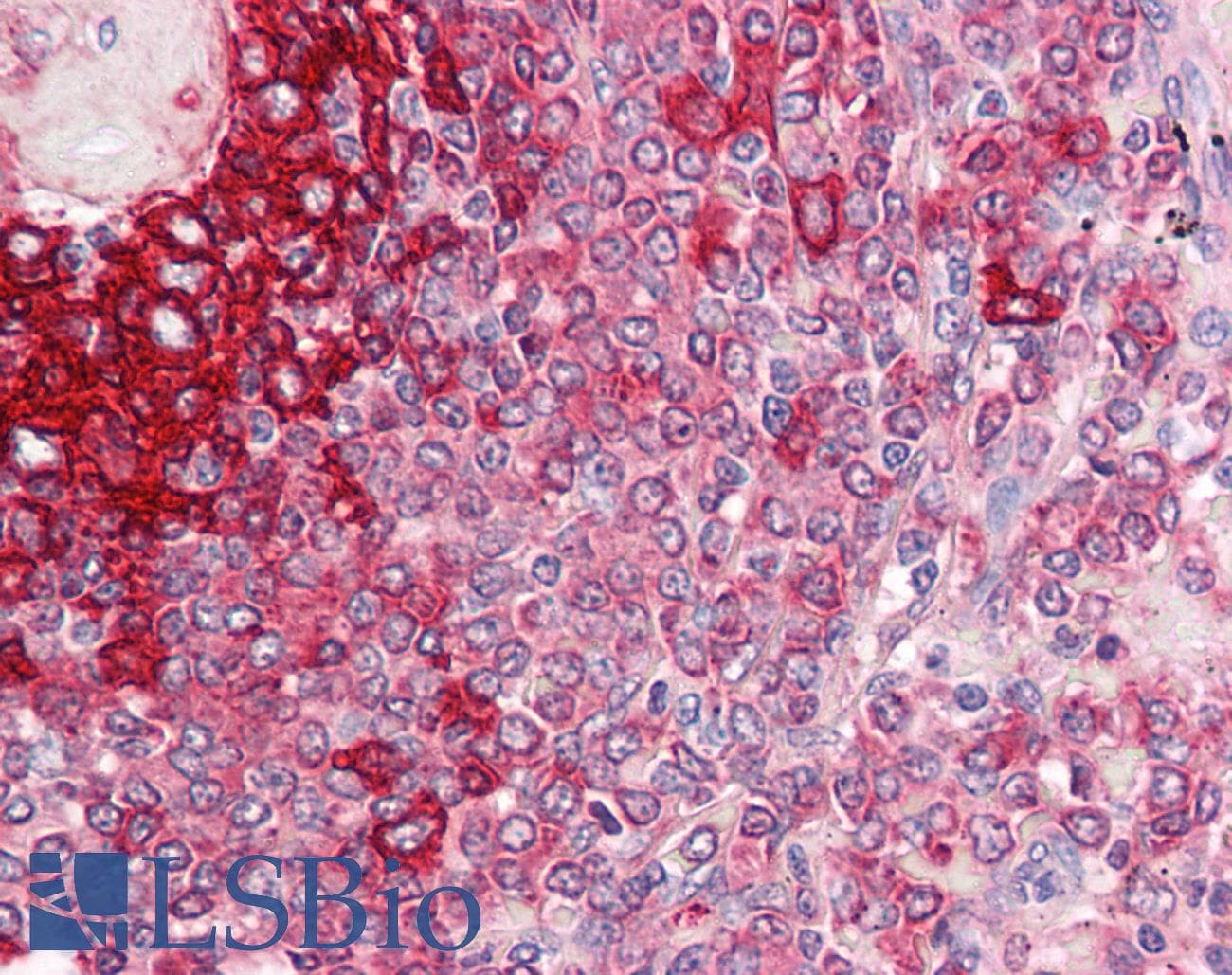 IHC-plus™ HLA-DR Antibody (clone LN3)