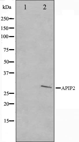 Polyclonal Rabbit anti-Human APAF1 / APAF-1 Antibody (IHC, IF, WB)