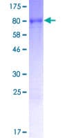Human MEX3C Protein (Recombinant GST)